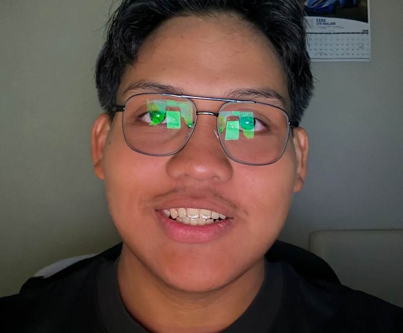 Reniel Alfred (22), $300, 