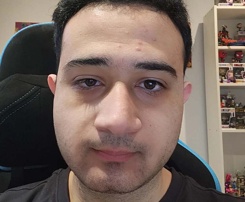 Naz