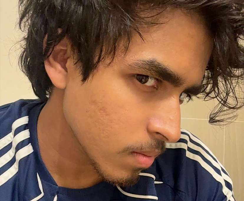 Dinil seniru (19), $250, 